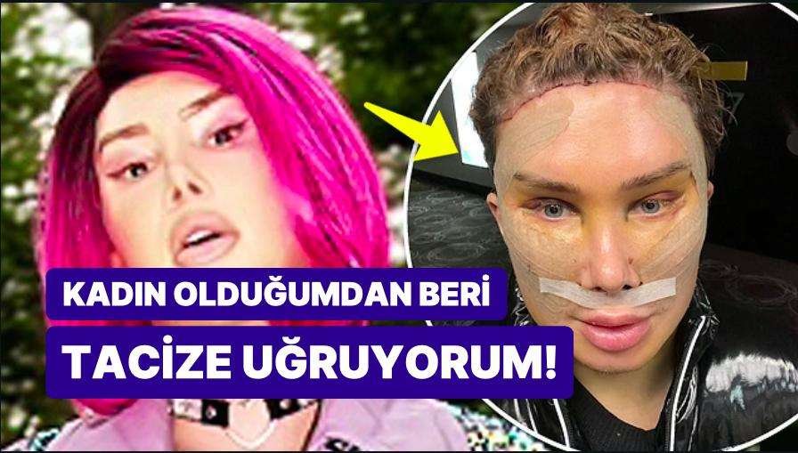 32 Ameliyat Geçiren TikTok Fenomeni Kararından Vazgeçti: ‘Yeniden Erkek Olmak İstiyorum’