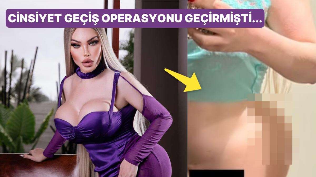 Popo Protezini Gösterdi! Cinsiyet Geçiş Operasyonu Geçiren Jessica Alves Yeni Ameliyatı İçin İstanbul’daydı