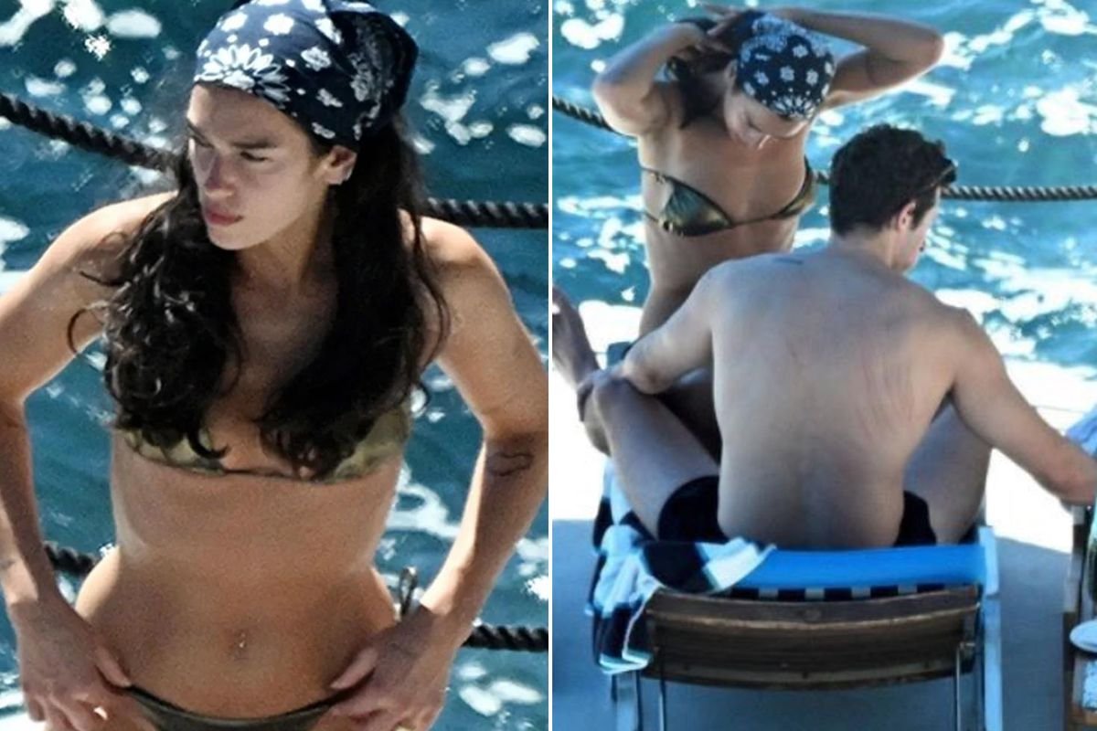 Dua Lipa’nın eşinin sırtındaki izler dikkat çekti